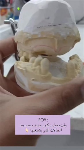 Hussein Khamis on Instagram‎: "#HawleyRetainer #LabialBow #AcrylicPlate #RetentionDevice #HawleyBraces #AdamsClasp #OrthodonticClasp #MolarClasp #StainlessSteelClasp #DentalRetention #OrthodonticSprings #FingerSpring #ZSpring #CoffinSpring #DentalSpring #PalatalExpander #HyraxExpander #HaasExpander #ExpansionScrew #OrthodonticExpander #RemovableAppliance #FunctionalAppliance #OrthodonticDevice #DentalAppliance #SmileCorrection #ToothMovement #OrthoTreatment #CustomRetainer #FixedRetainer #OrthoC