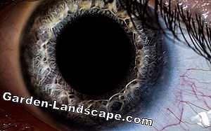 Plantes: Magnolia: Détecter et combattre les maladies et les ravageurs | 2025