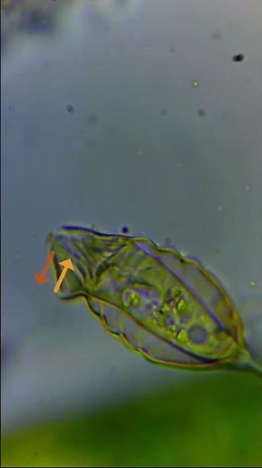 En copa con puerta automática: ciliado Pyxicola