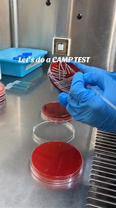1.5M views · 6.9K reactions | CAMP(Christie-Atkins-Munch-Petersen) test is a microbiological test that identifies the presence of group B streptococci (Streptococcus agalactiae) #reelsviralシ #fbreelsfypシ゚ #viralvideoシ #viralreelsfacebook #reelstrending #viralreelschallenge #science #virology #bdreels #microbiologylab #reelvideo2024 #microbiologylaboratory | Microbiologist BD | Facebook