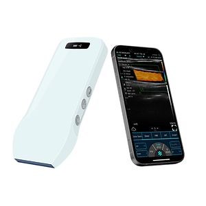 [Hot Item] Wireless Linear Array Ultrasound Scanner Handheld Device Probe for Superficial Structure Imaging