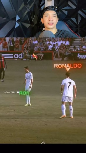 The Ball Hit A Boy's Hand #short #ryansport | Ryan Sport