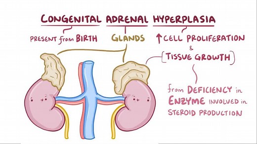 Video: Congenital adrenal hyperplasia - Video Explanation! | Osmosis | Osmosis