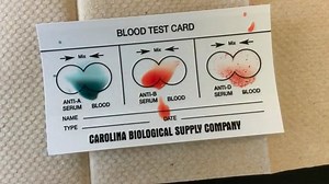 How to perform a blood typing test