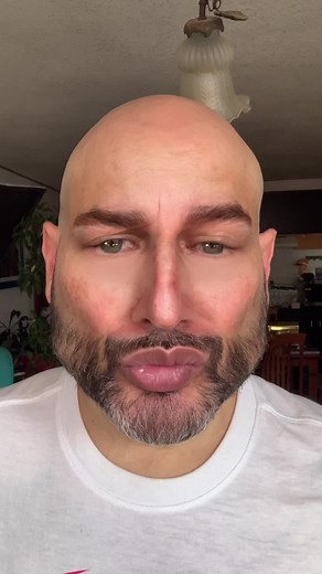 The audacity 🙄 #nofilters #natural #sorrynotsorry #TheAudacity | Pedro Kóminik Oficial