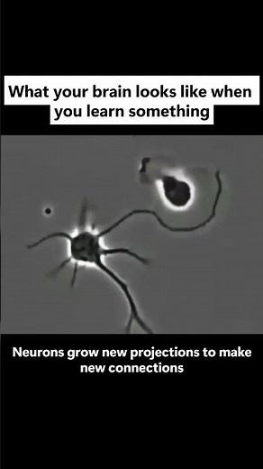 Learning Literally Changes Your Brain
