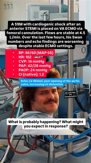 🫀🫁VA ECMO SCENARIO What do you think is happening and what might you expect? . Check out the ECMO CRASH COURSE and the other Nurse Dose Cheat Sheets/Resources in the bio! . Follow for more ICU nursing education! 🎓 . #cvicu #cardiacnurse #criticalcare #nursingschool #icunurse #newgradnurse #newgradrn #nursesofinstagram #icunurselife #flightnurse #criticalcarenurse #emergencydepartment #nurselife #paramedic #ernurses #medicalstudents | Nurse Dose Podcast