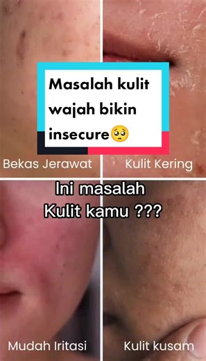 Atasi Masalah Kulit dengan Anime Instant Whitening Series