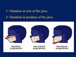 The Etiology of Malocclusion / Orthodontic