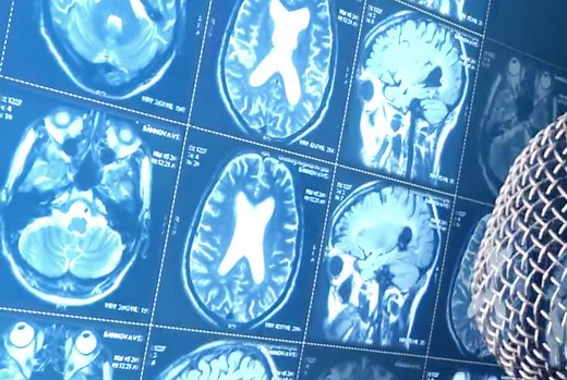 3.5K shares · 554 comments | The definitive guide to getting in the zone. Topics covered: flow state, repetition, and expedited learning. | Halo Neuroscience | Facebook