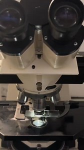 84K views · 1.6K reactions | Urine sample ❤️ #microscope #microbiology #parasites | Lab life | Facebook