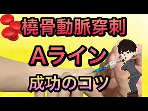 【研修医】Aライン（動脈路確保） 橈骨動脈穿刺のコツを詳しく解説！