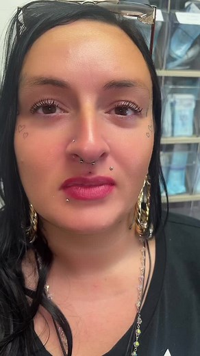 Cosmetic Lip Filler Procedure Explained