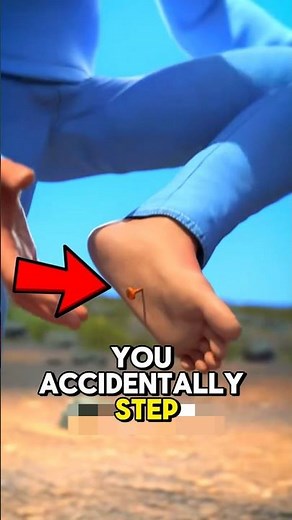 Here's What To Do If You Step On A Rusty Nail!😱