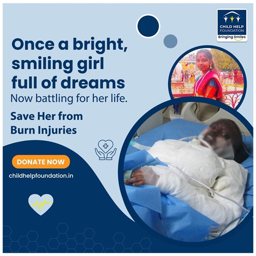 Once a bright, smiling girl full of dreams, dressed in colors and hope, Now battling for her life, wrapped in bandages, every breath a fight against 80% burns.. She is now in critical condition and fighting for her life in the ICU. Her mother, a nurse and the family’s only earner, is unable to bear the ₹15 lakh treatment cost. Manisha needs urgent ventilator support and intensive care. Your donation can be the reason she gets a second chance at life. Act now—every moment and every rupee matters.