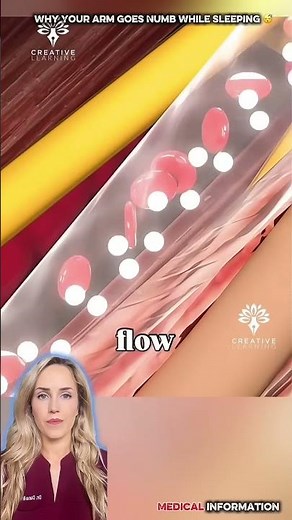 Why Your Arm Goes Numb While Sleeping #numbness #handnumbness #medicalanimations