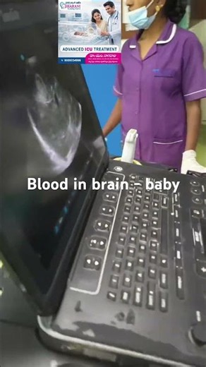 : Understanding Neonatal Intracranial Hemorrhage: A Case Study- blood in baby brain
