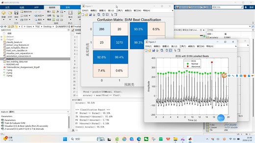【心电信号ECG】基于matlab SVM心电图心搏检测与分类【含Matlab源码 14982期】复现含文献