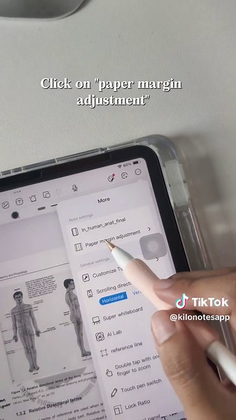 How to Adjust Paper Margins on Killer Notes