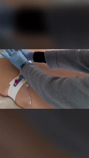 Catheter Care: No Urine in the Bag!