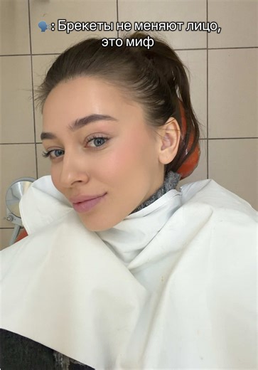 Когда увидела фотографии лица до установки брекетов, была в шоке Как будто скинула килограмм 5 #брекеты #зубы