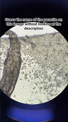 🪱 Enterobius vermicularis (Pinworm): The Common Intestinal Parasite You Should Know About!#pinworm