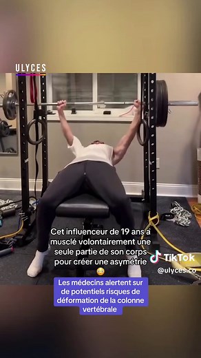 Influenceur 19 ans : muscler une seule partie du corps, quels risques ?