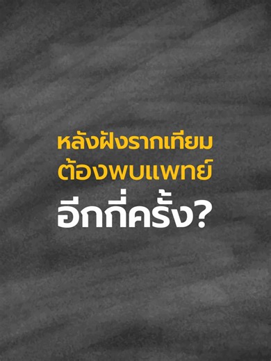 ฝังรากฟันเทียมครั้งเดียวจบเลยไหม? 🤔 . 🦷จริง ๆ แล้วหลังฝังรากฟันเทียม ต้องมีการนัดติดตามผลกับทันตแพทย์เป็นระยะ เพื่อดูการยึดติดกับกระดูกและวางแผนครอบฟันซี่ใหม่ให้สมบูรณ์ที่สุด ดูคลิปนี้ หมออธิบายครบว่าต้องพบแพทย์กี่ครั้งหลังฝังรากเทียม 👩‍⚕️ . 🦷 ที่ TC Smile By Vertex วางแผนการรักษาด้วยเทคนิค Nemo Smile 🖥️ ☑️ วางแผนฝังรากฟันเทียมได้ตรงตามตำแหน่งที่ต้องการ ☑️ ลดความผิดพลาดของการฝังรากฟันเทียม ☑️ มีความปลอดภัยสูงกว่าการฝังรากเทียมปกติ ☑️ ระยะเวลาในการผ่าตัดลดลง ☑️ ช่วยลดขนาดแผล และลดความเจ็บปวด