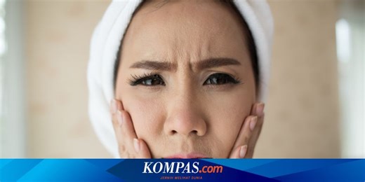 Stres Bikin Wajah Kusam dan Bermasalah, Ini Tips Perawatan dari Ahli