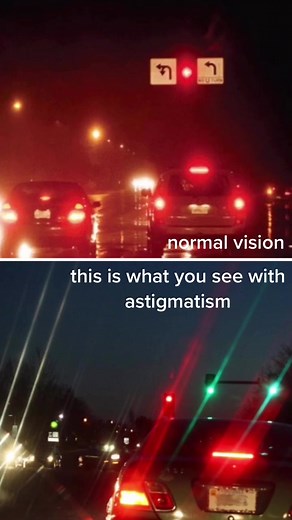 Understanding Astigmatism Symptoms and Treatment