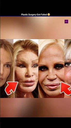 Plastic surgery gone wrong 😱