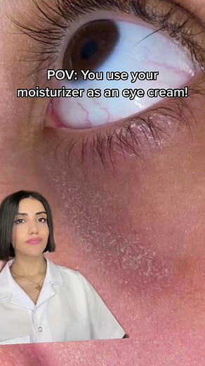 Moisturizer around eyes?