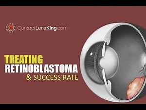 Retinoblastoma Treatment and Eye Cancer Survival Rate