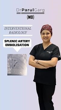 Life-Saving Intervention: The Role of Splenic Artery Embolization