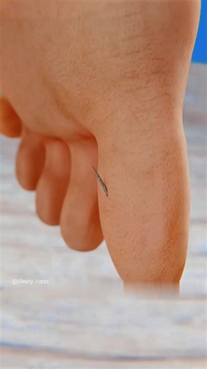Shady Facts on Instagram: "How To Remove A Deep Splinter Using The Syringe Vacuum Method 😯"