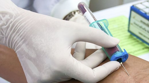 Ionogramme sanguin: Sodium, Potassium et Chlore