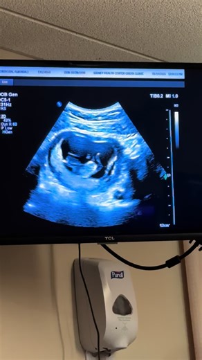 We made it into week 11!!! Had our first official OB appointment today and it went great! So many emotions walking into that office and it FINALLY being our time! I kept thinking how last pregnancy we had to terminate it before I even had my first appointment, so it was a big deal making it to today! Baby Robinson is doing amazing, growing like a weed and appears to have its father’s big ass head, yay…🙃 lol So happy to have reached another milestone, everyday I just can’t believe it’s even real