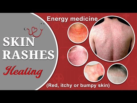 Energy Healing Meditation - Body Itching Healing || Healing Body Itching || Meditation Itching