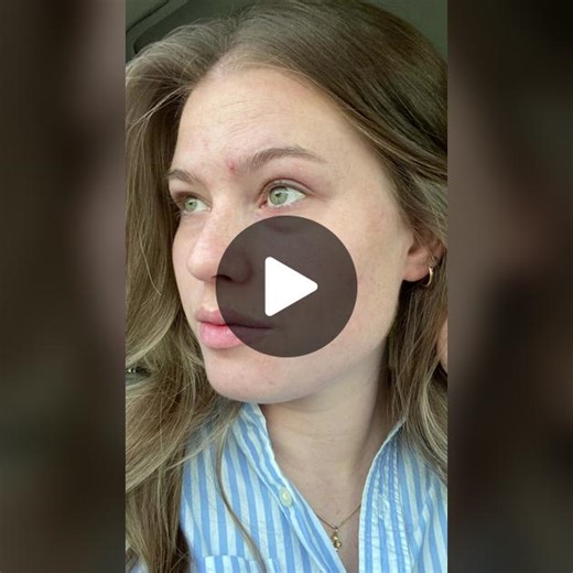 Transformative Skincare Before & After Moments