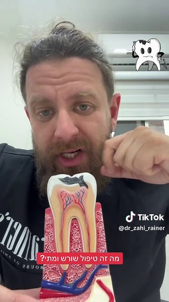 טיפול שורש שיניים: מתי ולמי זה מתאים?