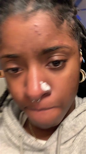 Tips for Removing Keloids on Nose Piercings