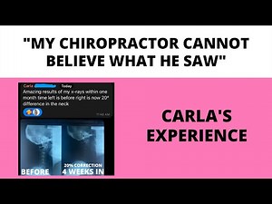 75% correction in Spinal Alignment - Ilana's Method review