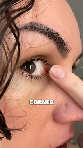 Why Your Eye Squeaks When Pressed 🤔