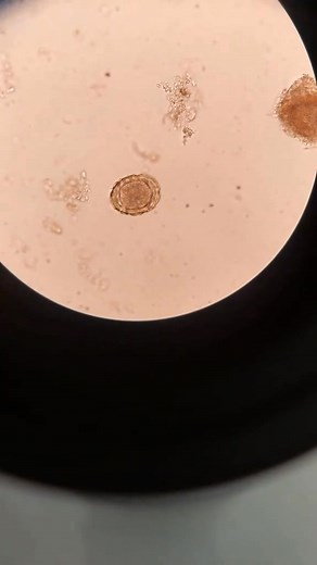 Stool sample 😍 #LabLife #microbiology #medicallaboratory | Lab life