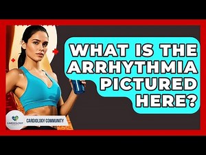 What Is The Arrhythmia Pictured Here? - Cardiology Community
