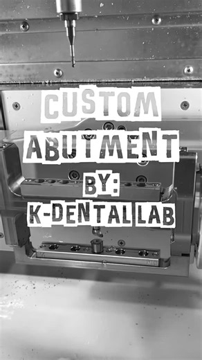 K-Dental Laboratory on Instagram: "“Precision that fits. Esthetics that last.” ✨ At K-Dental Lab, our custom abutments are designed and milled digitally to ensure optimal fit, function, and esthetics for every implant case. Partner with us to achieve seamless restorations and elevate your implant outcomes. #KDentalLab #CustomAbutment #ImplantDentistry #DigitalDentistry #CADCAM #PrecisionMilling #DentalInnovation #Prosthodontics #dentaltechnology #cadcamdentistry #arumdentistry #5x500 #digitalden