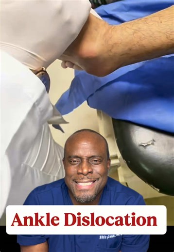 This looks intense, but it’s a real ankle injury that needed urgent realignment. Learn how quick action can protect circulation and prevent long-term issues. Watch how imaging tells the full story. #AnkleInjuryExplained #MedicalImaging #RadiologyEducation #JointHealth #InjuryRecovery Disclaimer: This content is for medical education purposes only and is not intended to substitute for professional medical advice, diagnosis, or care.