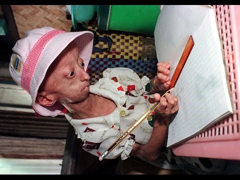 The Curious case of Benjamin Button