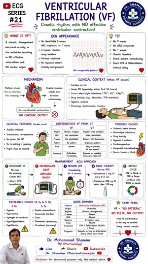 ❤️⚡ Ventricular Fibrillation (VF) Made Easy | ECG Recognition & Emergency Management |ECG Series #21