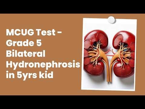 Hydronephrosis | My 5-Year-Old’s MCUG Test | What Parents Should Know